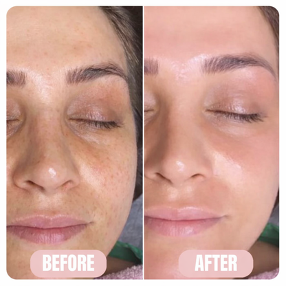 GLASS - COLLAGEN MASK